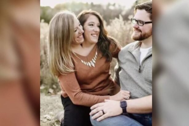 Älteste siamesische Zwillinge gestorben