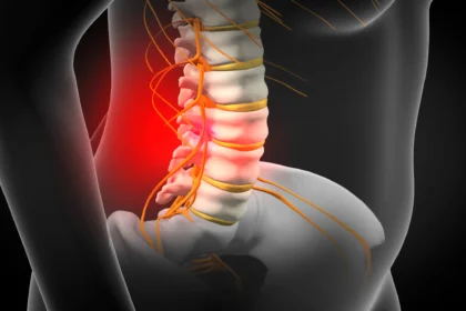 bandscheibenvorfall l5/s1 wie lange krank